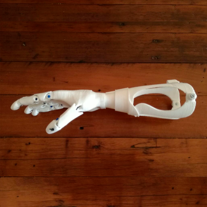Prototipo de soquete en prótesis impresión 3D